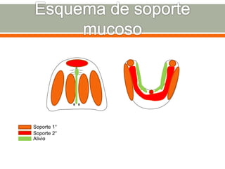 Soporte 1°
Soporte 2°
Alivio
 