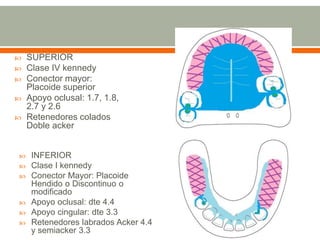  INFERIOR
 Clase I kennedy
 Conector Mayor: Placoide
Hendido o Discontinuo o
modificado
 Apoyo oclusal: dte 4.4
 Apoyo cingular: dte 3.3
 Retenedores labrados Acker 4.4
y semiacker 3.3
 SUPERIOR
 Clase IV kennedy
 Conector mayor:
Placoide superior
 Apoyo oclusal: 1.7, 1.8,
2.7 y 2.6
 Retenedores colados
Doble acker
 