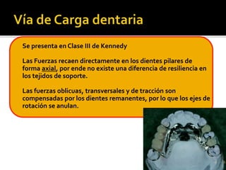  Se presenta en Clase III de Kennedy 
 Las Fuerzas recaen directamente en los dientes pilares de 
forma axial, por ende ...