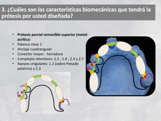 3. ¿Cuáles son las características biomecánicas que tendrá la
prótesis por usted diseñada?
• Prótesis parcial removible superior (metal-
acrílica)
• Palanca clase 1
• Anclaje cuadrangular
• Conector mayor: herradura
• Complejos retentivos: 1.5 , 1.4 , 2.3 y 2.7
• Apoyos cingulares: 1.1 (sobre fresado
palatino) y 2.3
 