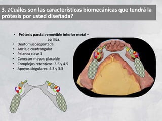 3. ¿Cuáles son las características biomecánicas que tendrá la
prótesis por usted diseñada?
• Prótesis parcial removible inferior metal –
acrílica.
• Dentomucosoportada
• Anclaje cuadrangular
• Palanca clase 1
• Conector mayor: placoide
• Complejos retentivos: 3.5 y 4.5
• Apoyos cingulares: 4.3 y 3.3
 
