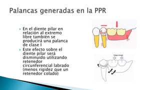  En el diente pilar en
relación al extremo
libre también se
producirá una palanca
de clase I
 Este efecto sobre el
diente pilar será
disminuido utilizando
retenedor
circunferencial labrado
(menos rigidez que un
retenedor colado)
 