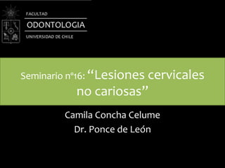 Seminario nº16: “Lesiones cervicales
no cariosas”
Camila Concha Celume
Dr. Ponce de León
 