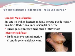 ¿En que ocasiones el odontólogo indica una licencia?
Cirugías Maxilofaciales:
En esta se indica licencia médica porque puede existir
una dificultad en la alimentación del paciente.
 Puede que se necesite medicación intravenosa
Infecciones difusas:
 En donde se ve comprometido
el estado general del paciente.
 