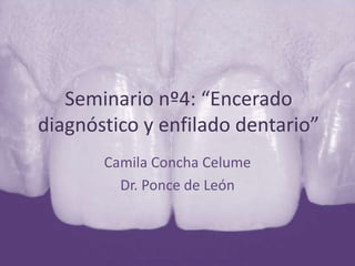 Seminario nº4: “Encerado
diagnóstico y enfilado dentario”
       Camila Concha Celume
         Dr. Ponce de León
 