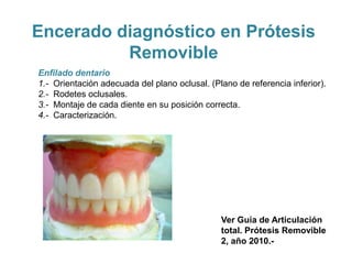 Encerado diagnóstico en Prótesis
          Removible
Enfilado dentario
1.- Orientación adecuada del plano oclusal. (Plano de referencia inferior).
2.- Rodetes oclusales.
3.- Montaje de cada diente en su posición correcta.
4.- Caracterización.




                                               Ver Guía de Articulación
                                               total. Prótesis Removible
                                               2, año 2010.-
 