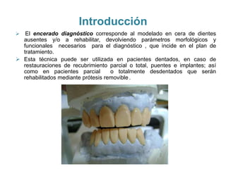Introducción
  El encerado diagnóstico corresponde al modelado en cera de dientes
  ausentes y/o a rehabilitar, devolviendo parámetros morfológicos y
  funcionales necesarios para el diagnóstico , que incide en el plan de
  tratamiento.
 Esta técnica puede ser utilizada en pacientes dentados, en caso de
  restauraciones de recubrimiento parcial o total, puentes e implantes; así
  como en pacientes parcial         o totalmente desdentados que serán
  rehabilitados mediante prótesis removible .
 