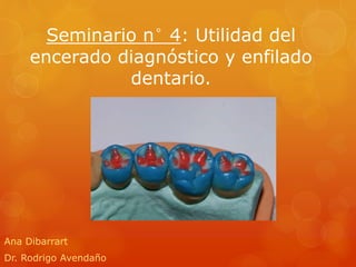 Seminario n° 4: Utilidad del
encerado diagnóstico y enfilado
dentario.
Ana Dibarrart
Dr. Rodrigo Avendaño
 