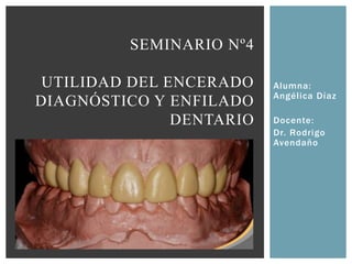 Alumna:
Angélica Díaz
Docente:
Dr. Rodrigo
Avendaño
SEMINARIO Nº4
UTILIDAD DEL ENCERADO
DIAGNÓSTICO Y ENFILADO
DENTARIO
 