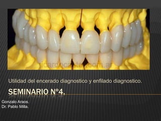SEMINARIO Nº4.
Utilidad del encerado diagnostico y enfilado diagnostico.
Gonzalo Araos.
Dr. Pablo Milla.
 