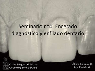Seminario nº4: Encerado
diagnóstico y enfilado dentario
Álvaro González O.
Dra. Marinkovic
Clínica Integral del Adulto
Odontología – U. de Chile
 