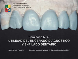 Universidad de Chile
Facultad de Odontología
Clínica Integral del Adulto I
Alumno: Luis Pulgar B. Docente: Macarena Miranda V. Fecha: 20 de Abril de 2014
 