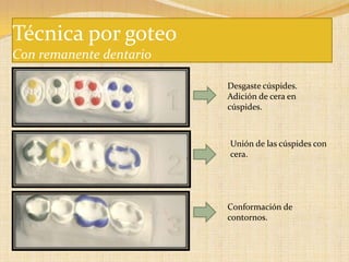 Técnica por goteo
Con remanente dentario
Desgaste cúspides.
Adición de cera en
cúspides.
Unión de las cúspides con
cera.
Conformación de
contornos.
 