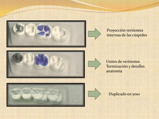 Proyección vertientes
internas de las cúspides
Unión de vertientes.
Terminación y detalles
anatomía
Duplicado en yeso
 