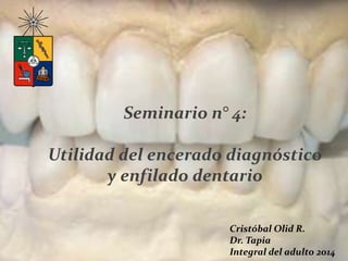Seminario n° 4:
Utilidad del encerado diagnóstico
y enfilado dentario
Cristóbal Olid R.
Dr. Tapia
Integral del adulto 2014
 