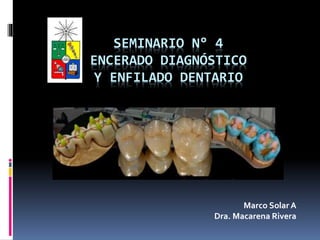 SEMINARIO N° 4
ENCERADO DIAGNÓSTICO
Y ENFILADO DENTARIO
Marco Solar A
Dra. Macarena Rivera
 