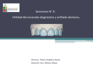 Seminario N° 4:
Utilidad del encerado diagnóstico y enfilado dentario.
Alumna : María Angélica Reyes
Docente: Dra. Milena Moya
 