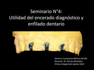 Seminario N°4:
Utilidad del encerado diagnóstico y
enfilado dentario
Alumna: Constanza Molina del Río
Docente: Dr. Rurico Montalva
Clínica Integral del adulto 2014
 
