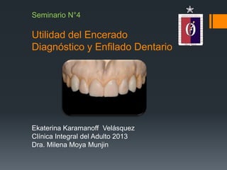 Seminario N°4

Utilidad del Encerado
Diagnóstico y Enfilado Dentario




Ekaterina Karamanoff Velásquez
Clínica Integral del Adulto 2013
Dra. Milena Moya Munjin
 