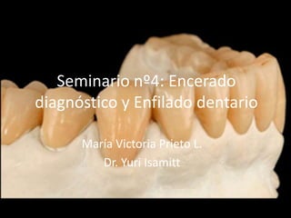 Seminario nº4: Encerado
diagnóstico y Enfilado dentario
María Victoria Prieto L.
Dr. Yuri Isamitt
 