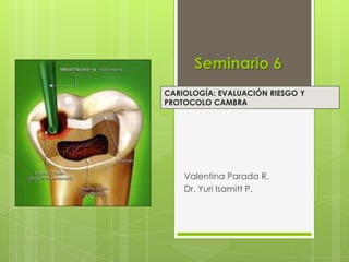 Seminario 6
Valentina Parada R.
Dr. Yuri Isamitt P.
CARIOLOGÍA: EVALUACIÓN RIESGO Y
PROTOCOLO CAMBRA
 