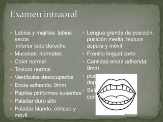 Labios y mejillas: labios
secos
inferior lado derecho
 Mucosas: normales
 Color normal
 Textura normal
 Vestíbulos desocupados
 Encia adherida: 9mm
 Papilas piriformes ausentes
 Paladar duro alto
 Paladar blando, oblicuo y
móvil
 Lengua grande de posición,
posición media, textura
áspera y móvil
 Frenillo lingual corto
 Cantidad encía adherida:
9mm
 piso de boca alto y
depresible
 Saliva abundante y
consistencia mixta
 