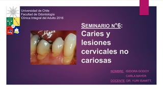 SEMINARIO N°6:
Caries y
lesiones
cervicales no
cariosas
NOMBRE: ISIDORA GODOY
CARLA MAYER
DOCENTE: DR. YURI ISAMITT.
Universidad de Chile
Facultad de Odontología
Clínica Integral del Adulto 2016
 