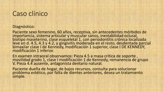 Caso clínico
Diagnóstico:
Paciente sexo femenino, 60 años, receptiva, sin antecedentes mórbidos de
importancia, sistema articular y muscular sanos, inestabilidad oclusal,
biotipo maseterino, clase esqueletal 1, con periodontitis crónica localizada
leve en d. 4.5, 4.3 y 4.2, y gingivitis moderada en el resto, desdentada parcial
bimaxilar clase I de Kennedy, modificación 1 superior, clase I DE KENNEDY,
modificación 1 inferior.
En examen intraoral observamos: Pieza 4.5 a masa crítica de soporte ,
movilidad grado 1, clase I modificación 1 de Kennedy, remanencia de grupo
V. Pieza 4.4 ausente, antagonista dentario natural.
Paciente dueña de hogar, de bajos recursos, consulta para solucionar
problema estético, por falta de dientes anteriores, desea un tratamiento
simple.
 