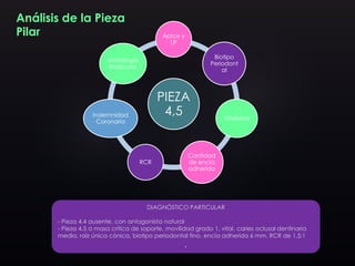 Análisis de la Pieza
Pilar
PIEZA
4,5
Ápice y
LP
Biotipo
Periodont
al
Vitalidad
Cantidad
de encía
adherida
RCR
Indemnidad
Coronaria
Morfología
Radicular
DIAGNÓSTICO PARTICULAR
- Pieza 4.4 ausente, con antagonista natural
- Pieza 4.5 a masa crítica de soporte, movilidad grado 1, vital, caries oclusal dentinaria
media, raíz única cónica, biotipo periodontal fino, encía adherida 6 mm, RCR de 1,5:1
.
 