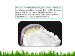 Una vez terminado el encerado, se le toma una impresión
de silicona para obtener una guía de los perfiles dentarios,
que le sirve de referencia al odontólogo al hacer las
preparaciones, considerando el grosor de la porcelana o
metal con que se hará la corona o la carilla.
 