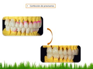 • Confección de provisorios
 