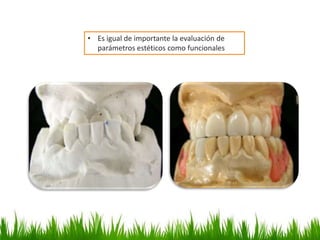 • Es igual de importante la evaluación de
parámetros estéticos como funcionales
 