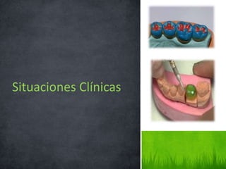Situaciones Clínicas
 