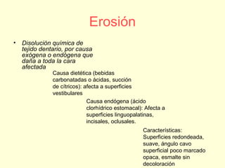 Erosión
• Disolución química de
tejido dentario, por causa
exógena o endógena que
daña a toda la cara
afectada
Causa dietética (bebidas
carbonatadas o ácidas, succión
de cítricos): afecta a superficies
vestibulares
Causa endógena (ácido
clorhídrico estomacal): Afecta a
superficies linguopalatinas,
incisales, oclusales.
Características:
Superficies redondeada,
suave, ángulo cavo
superficial poco marcado
opaca, esmalte sin
decoloración
 