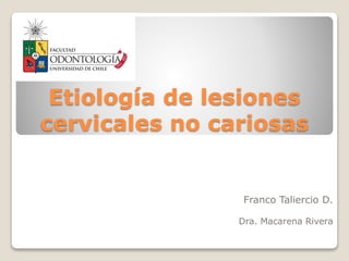 Etiología de lesiones
cervicales no cariosas
Franco Taliercio D.
Dra. Macarena Rivera
 