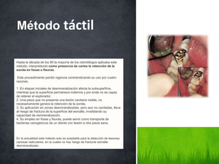 Hasta la década de los 80 la mayoría de los odontólogos aplicaba este
método, interpretando como presencia de caries la retención de la
sonda en fosas o fisuras.
Este procedimiento perdió vigencia contraindicando su uso por cuatro
razones.
1. En etapas iniciales de desmineralización afecta la subsuperficie,
mientras que la superficie permanece indemne y por ende no es capaz
de retener el explorador.
2. Una pieza que no presenta una lesión cavitaria visible, no
necesariamente genera la retención de la sonda.
3. Su aplicación en zonas desmineralizadas, pero aun no cavitadas, lleva
al riesgo de fractura de la superficie del esmalte, invalidando su
capacidad de remineralización.
4. Su empleo en fosas y fisuras, puede servir como transporte de
bacterias cariogénicos de un diente con lesión a otra pieza sana.
En la actualidad este método solo es aceptable para la detección de lesiones
cariosas radiculares, en la cuales no hay riesgo de fracturar esmalte
desmineralizado.
Método táctil
 