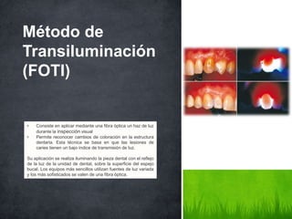Método de
Transiluminación
(FOTI)
• Consiste en aplicar mediante una fibra óptica un haz de luz
durante la inspección visual
• Permite reconocer cambios de coloración en la estructura
dentaria. Esta técnica se basa en que las lesiones de
caries tienen un bajo índice de transmisión de luz.
Su aplicación se realiza iluminando la pieza dental con el reflejo
de la luz de la unidad de dental, sobre la superficie del espejo
bucal. Los equipos más sencillos utilizan fuentes de luz variada
y los más sofisticados se valen de una fibra óptica.
 