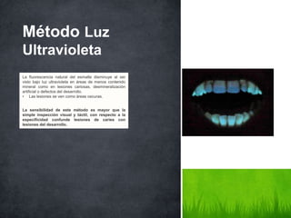 Método Luz
Ultravioleta
La fluorescencia natural del esmalte disminuye al ser
visto bajo luz ultravioleta en áreas de menos contenido
mineral como en lesiones cariosas, desmineralización
artificial o defectos del desarrollo.
• Las lesiones se ven como áreas oscuras.
La sensibilidad de este método es mayor que la
simple inspección visual y táctil, con respecto a la
especificidad confunde lesiones de caries con
lesiones del desarrollo.
 