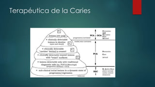 Terapéutica de la Caries
 