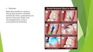  Sellantes:
Materiales puestos en puntos y
fisuras para prevenir o detener
lesiones de caries, proveyendo una
barrera física que inhibe a los
microorganismos y evita la
acumulación de alimentos.
 
