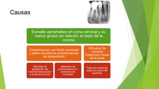 Causas
Esmalte aprismático en zona cervical y su
menor grosor en relación al resto de la
corona
Contaminación con fluído crevicular
y saliva durante los procedimientos
de restauración
Dificultad de
adaptación del
material restauración
a la pared cervical
Alteración de
polimerización en
presencia de
humedad
Dificultad de
correcta
inspección visual
de la zona
Falta de control de
placa por parte del
paciente
 