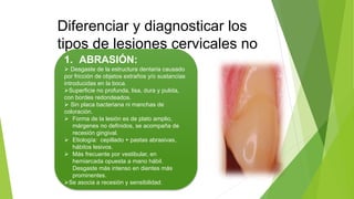 Diferenciar y diagnosticar los
tipos de lesiones cervicales no
cariosas.1. ABRASIÓN:
 Desgaste de la estructura dentaria causado
por fricción de objetos extraños y/o sustancias
introducidas en la boca.
Superficie no profunda, lisa, dura y pulida,
con bordes redondeados.
 Sin placa bacteriana ni manchas de
coloración.
 Forma de la lesión es de plato amplio,
márgenes no definidos, se acompaña de
recesión gingival.
 Etiología: cepillado + pastas abrasivas,
hábitos lesivos.
 Más frecuente por vestibular, en
hemiarcada opuesta a mano hábil.
Desgaste más intenso en dientes más
prominentes.
Se asocia a recesión y sensibilidad.
 