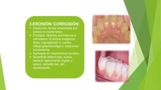 3.EROSIÓN/ CORROSIÓN:
 Disolución dental ocasionada por
ácidos no bacterianos.
 Etiología: factores extrínsecos e
intrínsecos  ácidos exógenos,
dieta, regurgitación o vomito,
reflujo gastroesofágico, trastornos
alimentarios.
 Agravada en respiradores bucales.
 Superficie defectuosa, suave,
aspecto ligeramente rugoso y
opaco, esmalte liso, sin
decoloración.
 