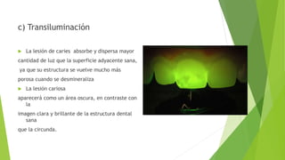 c) Transiluminación
 La lesión de caries absorbe y dispersa mayor
cantidad de luz que la superficie adyacente sana,
ya que su estructura se vuelve mucho más
porosa cuando se desmineraliza
 La lesión cariosa
aparecerá como un área oscura, en contraste con
la
imagen clara y brillante de la estructura dental
sana
que la circunda.
 