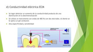 d) Conductividad eléctrica ECM
 Se logar detectar un aumento de la conductividad producto de una
disminución en la desmineralización
 Se utiliza un instrumento con ondas de 400 Hz con dos elecrodos. Al diente se
le aplica un gel conductor.
 Alta especificidad y sensibilidad
 