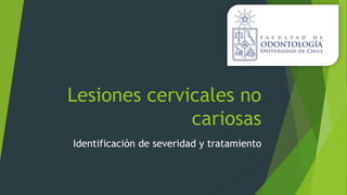 Lesiones cervicales no
cariosas
Identificación de severidad y tratamiento
 