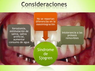 Síndrome
de
Sjogren
Xerostomía,
estimulación de
saliva, saliva
artificial,
aumentar
consumo de agua
No se reportan
diferencias en la
oseointegración
Intolerancia a las
prótesis
removibles
 