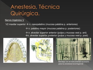 Nervio trigémino V
V2 maxilar superior  n. nasopalatino (mucosa palatina p. anteriores)
 n. palatino mayor (mucosa palatina p. posteriores)
 n. alveolar superior anterior (pulpa y mucosa vest p. ant)
n. alveolar superior posterior (pulpa y mucosa vest p. post)
Bandeja con el instrumental necesario
para la anestesia locorregional.
 