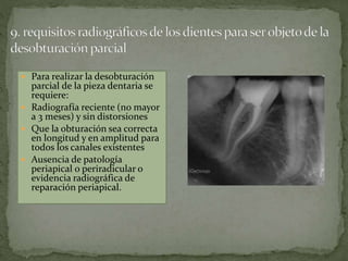  Para realizar la desobturación
parcial de la pieza dentaria se
requiere:
Radiografía reciente (no mayor
a 3 meses) y sin distorsiones
Que la obturación sea correcta
en longitud y en amplitud para
todos los canales existentes
Ausencia de patología
periapical o periradicular o
evidencia radiográfica de
reparación periapical.