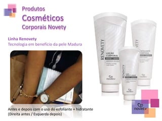 Produtos
Cosméticos
Corporais Novety
Linha Renovety
Tecnologia em benefício da pele Madura
Antes e depois com o uso do esfoliante + hidratante
(Direita antes / Esquerda depois)
 